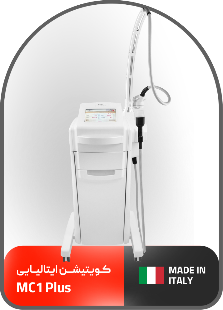 کویتیشن ایتالیایی